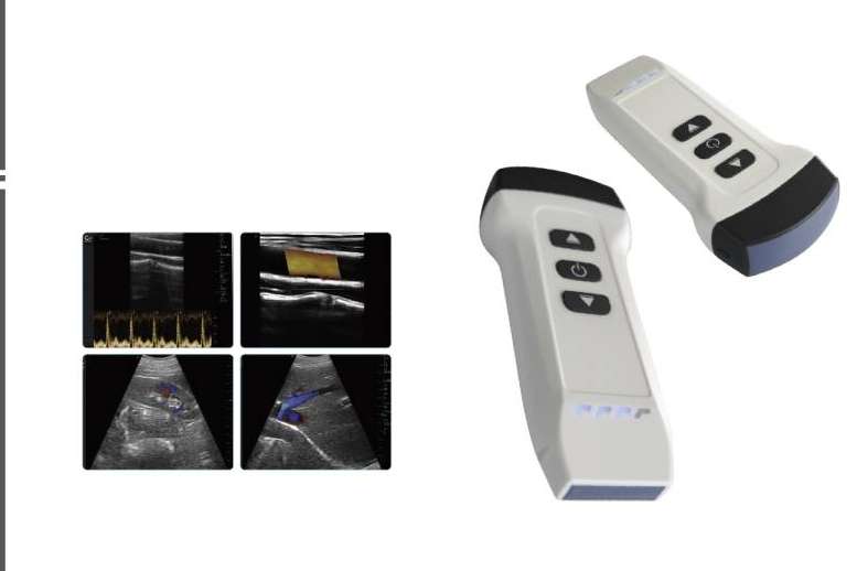 Ecógrafos portátiles de SCPmedical, diseño compacto para diagnósticos precisos
