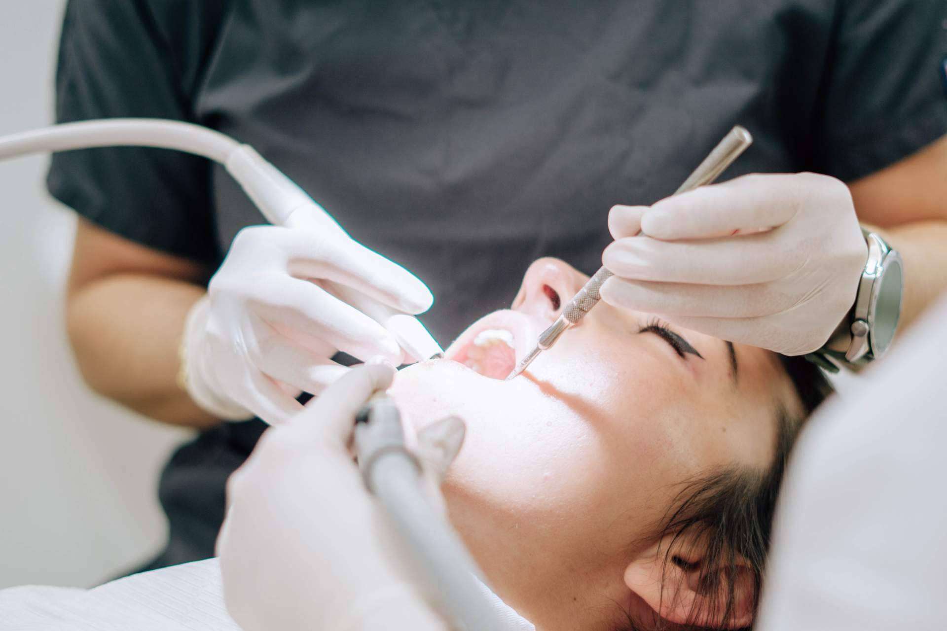 Cómo hacer bien (y conservar) el blanqueamiento dental